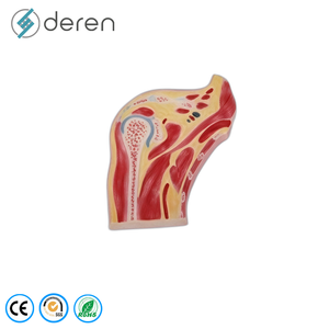 Ensemble de 4 modèles pathologiques de l'articulation du genou, modèle d'anatomie du genou en stade d'<span class=keywords><strong>arthrose</strong></span> pour l'enseignement médical - Product Image 2