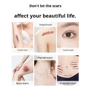 Patch cicatrisant <span class=keywords><strong>en</strong></span> <span class=keywords><strong>silicone</strong></span> à marque privée, désinfectant à infrarouge lointain <span class=keywords><strong>pour</strong></span> les brûlures, post-opératoire, bandages de césarienne - Product Image 2