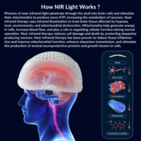 Casque de stimulation cérébrale profonde ZJZK 810nm à lumière infrarouge proche avec neurofeedback pour la thérapie de réadaptation neurologique de l'anxiété