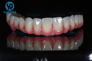 Fresadora Dental <span class=keywords><strong>CAD</strong></span> CAM YUCERA y Fabricante de Materiales y Equipos Dentales <span class=keywords><strong>CAD</strong></span> CAM, Fresadora para Laboratorio Dental - Product Image 5