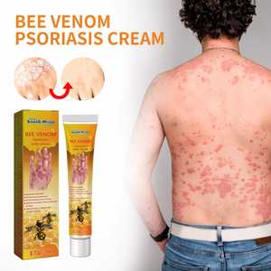 Krim <span class=keywords><strong>Psoriasis</strong></span>, krim kulit infeksi jamur 20G salep Dermatitis Eczema perawatan <span class=keywords><strong>Psoriasis</strong></span> - Product Image 2