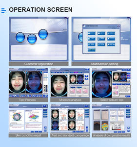 बेको पेशेवर त्वचा परीक्षण चेहरे स्कैन त्वचा विश्लेषक सौंदर्यशास्त्र त्वचा परीक्षण चेहरे स्कैन त्वचा विश्लेषक - Product Image 3