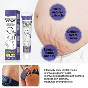 Crème Réparatrice Vergetures aux Perles – Estompe les Marques de Croissance et d'Obésité – Soin Post-partum et Cicatrices de <span class=keywords><strong>Grossesse</strong></span> – Crème Corporelle Maternité - Product Image 4