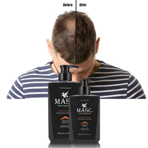 迷迭香油生物素防脱发定制标志私人标签男士头发生长洗发水和护发素