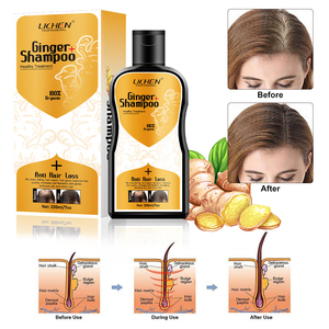 Shampoo <span class=keywords><strong>anti</strong></span>-<span class=keywords><strong>chute</strong></span> de cheveux en marque privée, <span class=keywords><strong>meilleur</strong></span> shampooing contre la perte de cheveux, shampooing <span class=keywords><strong>anti</strong></span>-<span class=keywords><strong>chute</strong></span> - Product Image 5