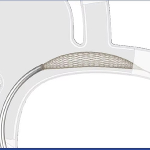 מכונת הצמה אוטומטית במהירות גבוהה עבור צינור הלב חוט כירורגי צינור לב - Product Image 1