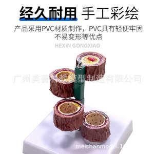 Modèle vasculaire humain ; vaisseaux sanguins/occlusion ; vaisseaux sanguins chez les personnes âgées ; embolie/blocage/modèle ; modèle vasculaire/PATHOLOGIQUE - Product Image 5