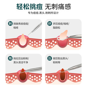 Aiguille anti-acné en acier inoxydable, outil de soin du visage, extracteur de points noirs pour le soin de la peau du visage - Product Image 3