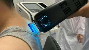 Dispositivo de Fototerapia Excimer Profesional KN-5000C de 308nm para Uso Clínico en Dermatología, No Invasivo, Solución para el Vitiligo - Product Image 4