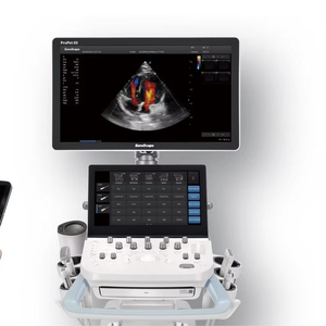 Système d'échographie Doppler couleur vétérinaire Sonoscape ProPet60, échocardiographie, prix de l'échographie pour animaux - Product Image 1