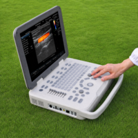 Valid CE SONOIMAGE Veterinary N20 Doppler Ultrasound Class II Medical Instrument Ensures Precise Diagnostic Imaging on Farms