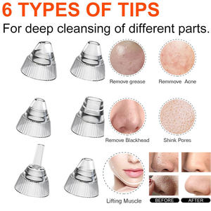 ブラックヘッドリムーバー毛穴真空カメラ毛穴クリーナーアクネリムーバー電気加熱鼻顔ディープクレンジングWIFI顕微鏡 - Product Image 2