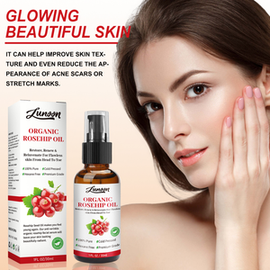 OEM/ODM Vitamine C Vergetures Acné Cicatrice Éclaircissant Blanchiment <span class=keywords><strong>Anti</strong></span>-âge Huile de Rose Musquée Soins de la Peau Sérum <span class=keywords><strong>Visage</strong></span> Bouteille 30ml - Product Image 3