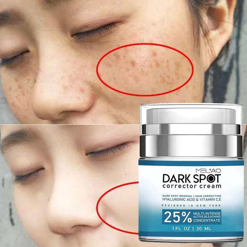 Private Label Koreaanse Dark Spot Verwijderingscrème Anti-Aging Whitening Gezichtscrème Voor Het Verwijderen Van Donkere Vlek