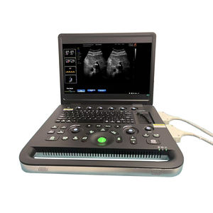 Escáner de Ultrasonido Veterinario Portátil Digital 3D con Doppler Color, Ecógrafo Doppler Color, Ultrasonido Veterinario - Product Image 5