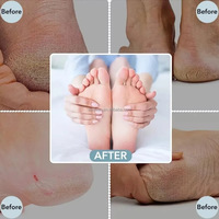 Lime à pied professionnelle en acier inoxydable meuleuse de callosités pierre de pédicure Double élimination de la peau morte Kit de soins de soins-Stock