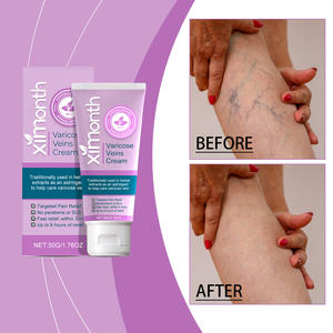 Relieves Legs Pain Smoothing and Moisturizing Skin Health Care <strong>Varicose</strong> <strong>Veins</strong> <strong>Treatment</strong> <strong>Cream</strong> - Product Image 2