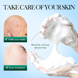 OEM ODM Oli Control Clean Acnes Tratamiento Limpiador facial Espuma Lavado facial para el cuidado de la piel Belleza Árbol de té Lavado facial - Product Image 4
