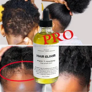 China Fabriek Private Label Rozemarijn Haarversterkende Olie Serum Organische Haargroei Olie Voor Afro Haar Zwarte Vrouwen