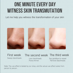 PAKISS Thiết Bị Làm Sạch Da Máy Làm Sạch Lỗ Chân Lông Máy Hút Mụn Đầu Đen Có Thể Nhìn Thấy Máy Làm Sạch Mặt Mụn Đầu Đen - Product Image 5