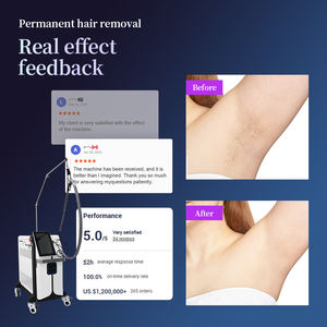 Appareil de réduction des poils au <span class=keywords><strong>laser</strong></span> Alexandrite 755 nm avec système de refroidissement avancé pour les centres de dermatologie - Product Image 3