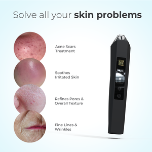Appareil anti-âge innovant pour usage domestique et professionnel, Leaflife Mjolnir Mate, pour le lifting du cou et du visage, l'élimination des tags, des grains de beauté et de l'acné - Product Image 2
