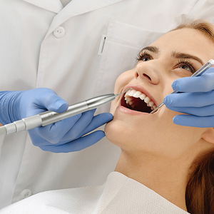 Punta ultrasónica dental de aire comprimido universal Kv para eliminar sarro y limpiar dientes, equipo con certificación CE - Product Image 3