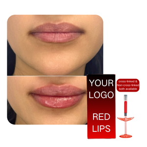 Remplisseur Lèvres Rouge Injectable Sûr 1ml avec Vitamine B12 et <span class=keywords><strong>Acide</strong></span> <span class=keywords><strong>Hyaluronique</strong></span> – Redéfinit les Lignes des Lèvres – <span class=keywords><strong>Prix</strong></span> Usine Compétitif en Gros - Product Image 2
