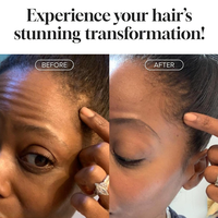 Shampooing et après-shampoing végétaliens à la biotine pour la croissance des cheveux, anti-chute, renforçant la densité, marque privée