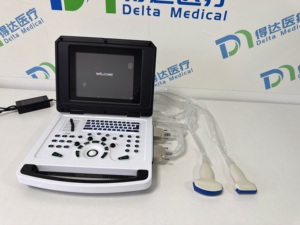 Escáner de Ultrasonido Blanco y Negro de Alta Calidad para Hospital, Sistema de Diagnóstico Veterinario, Máquina de Ultrasonido Portátil para Humanos - Product Image 1