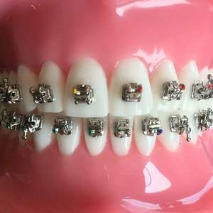 Soporte dental fijo con arco, material <span class=keywords><strong>de</strong></span> alambre para <span class=keywords><strong>dientes</strong></span> <span class=keywords><strong>de</strong></span> ortodoncia, desechable, <span class=keywords><strong>de</strong></span> metal - Product Image 6