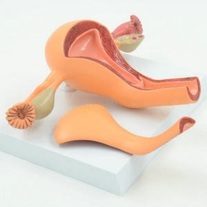 Le modèle de système reproducteur anatomique féminin en PVC pour l'éducation médicale comprend l'utérus, le vagin et l'ovaire avec pathologie - Product Image 4