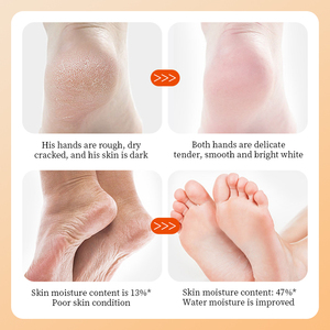 OEM SADOER Marque privée Vitamine C Masque nourrissant pour les pieds Blanchiment Éclaircissant Élimination des <span class=keywords><strong>callosités</strong></span> de la peau morte Masques pour les pieds en feuille souple - Product Image 6