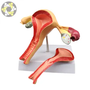 Plastic Female Normal Anatomical Uterus Vagina Model