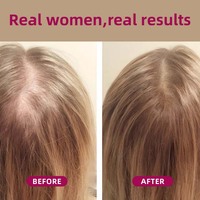 Compléments alimentaires pour la croissance des cheveux avec biotine et collagène marin pour nourrir les cheveux clairsemés, améliorer la croissance et l'épaisseur des cheveux pour les femmes