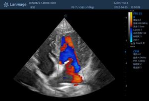 C6 수의용 휴대용 초음파 기기 15인치 <span class=keywords><strong>HD</strong></span> LED, 지능형 밝기 조절, ECG 모듈, 빠른 부팅 클리닉용 - Product Image 2