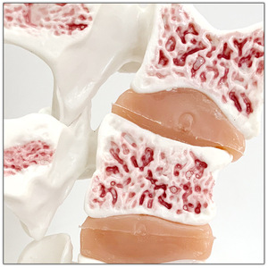 Modelo de osteoporosis de hueso humano Anatomía lumbar patológica Modelo de enseñanza de sección transversal espinal - Product Image 4