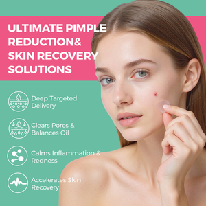 แผ่นแปะรักษา<span class=keywords><strong>สิว</strong></span>แบบไฮโดรคอลลอยด์สำหรับวัยรุ่น ปรับแต่งได้ ลดรอยสิว ผิวหน้าใส สไตล์เกาหลี - Product Image 3