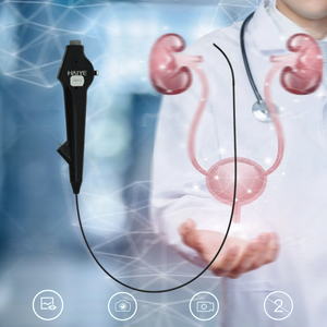 Ureteroscopio Flexible Redpine, Uroscopio, Ureteroscopios, Dispositivo Endoscópico con Cámara - Product Image 3