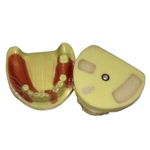 Aides pédagogiques dentaires Modèle de formation aux implants dentaires - Product Image 1