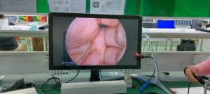 24 "मेडिकल मॉनिटर प्रदर्शन वीडियो एंडोस्कोपिक लैप्रोस्कोपी कैमरों ने सर्जिकल कैमरा सिस्टम के लिए लाइट सोर्स एचडी एंडोस्कोप कैमरा का नेतृत्व किया - Product Image 4