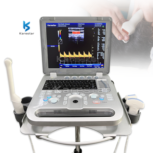 Ecógrafo Doppler a Color 3D de Alta Calidad para Vaca, Caballo, Oveja y Perro, Máquina de Ultrasonido Basada en Plataforma de PC - Product Image 1