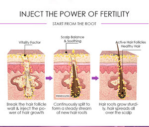 Ce n'est pas grave si vous noir ou blanc huile de ricin croissance des cheveux huile sérum renforcer le cuir chevelu ensemble de soins capillaires - Product Image 5