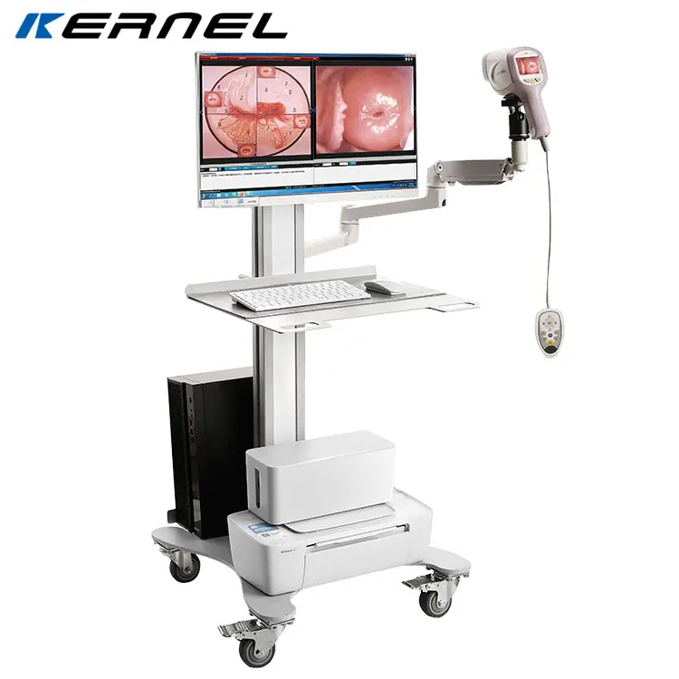 Kernel KN-2200I (Hd) Gynaecologie Beeldvormingssysteem Medisch Ziekenhuis Gespecialiseerd Endoscopietrolley Digitale Optische Colposcoop