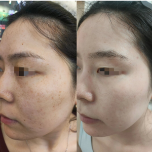 Crème Correctrice de Taches OEM Soin Quotidien de la Peau Estompe Doucement les Taches de Rousseur et les Taches Brunes Éclaircit le Teint Terne Unifie le Teint - Product Image 4