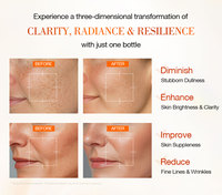 Sérum Visage Neutriherbs Marque Privée Anti-Taches, Éclaircissant et Illuminateur, Boostant le Collagène, 20% Vitamine C Plus
