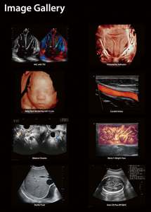 Sonosape P25Elite troli warna Digital, pemindai Ultrasound resolusi tinggi 3D/4D/5D dengan Diagnosis bantuan AI - Product Image 5