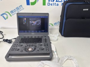 Échographe portable Sonoscape X3, échographe Doppler couleur pour usage humain, imagerie haute définition pour les urgences et le diagnostic - Product Image 3