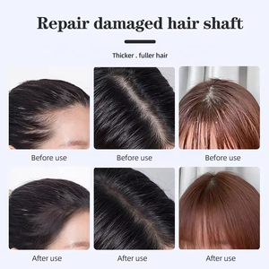 Dermatoscópio para Uso Doméstico Diagnóstico do Couro Cabeludo Detecção de Umidade Analisador de Pele e Cabelo com Tela - Product Image 6