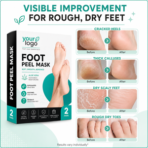 Masque exfoliant pour les pieds OEM, élimine les peaux mortes, adoucit les talons gercés, élimine les callosités épaisses, nourrit les pieds rugueux et secs, hydrate les pieds - Product Image 2